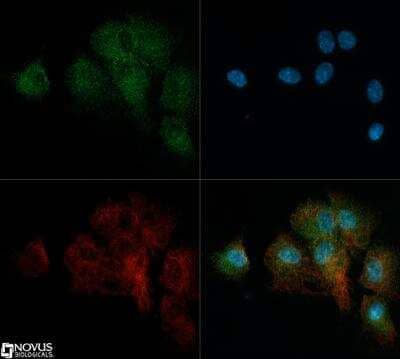Immunocytochemistry/ Immunofluorescence: ROBO4 Antibody [NB110-58778]