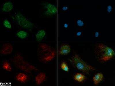 Immunocytochemistry/ Immunofluorescence: ROBO4 Antibody [NB110-58780]