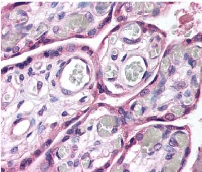 Immunohistochemistry: ROBO4 Antibody [NB110-58780]