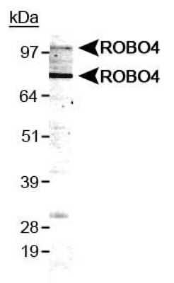 Western Blot: ROBO4 Antibody [NB110-58778]