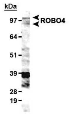 Western Blot: ROBO4 Antibody [NB110-58780]