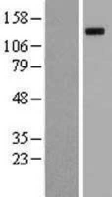 Western Blot: ROBO4 Overexpression Lysate [NBL1-15473]