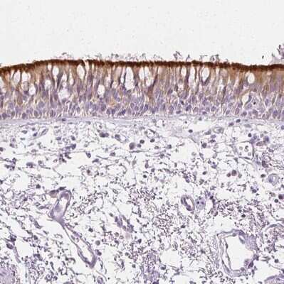 Immunohistochemistry-Paraffin: Ropporin 1-like Antibody [NBP1-90081]