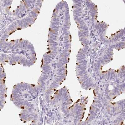 Immunohistochemistry-Paraffin: Ropporin 1-like Antibody [NBP1-90081]