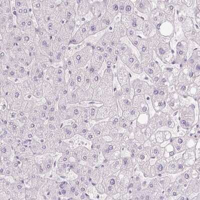 Immunohistochemistry-Paraffin: Ropporin 1-like Antibody [NBP1-90081]