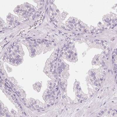 Immunohistochemistry-Paraffin: Ropporin 1-like Antibody [NBP1-90081]