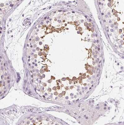 Immunohistochemistry-Paraffin: Ropporin 1-like Antibody [NBP1-90081]