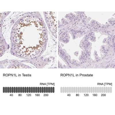 Immunohistochemistry-Paraffin: Ropporin 1-like Antibody [NBP1-90081]