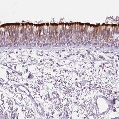 Immunohistochemistry-Paraffin: Ropporin 1-like Antibody [NBP2-47299]