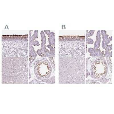 Immunohistochemistry-Paraffin: Ropporin 1-like Antibody [NBP2-47299]