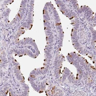 Immunohistochemistry-Paraffin: Ropporin 1-like Antibody [NBP2-47299]