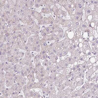 Immunohistochemistry-Paraffin: Ropporin 1-like Antibody [NBP2-47299]