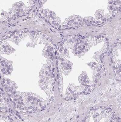 Immunohistochemistry-Paraffin: Ropporin 1-like Antibody [NBP2-47299]