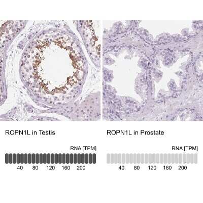 Immunohistochemistry-Paraffin: Ropporin 1-like Antibody [NBP2-47299]