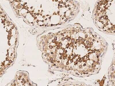 Immunohistochemistry-Paraffin: Ropporin 1-like Antibody [NBP2-99172]