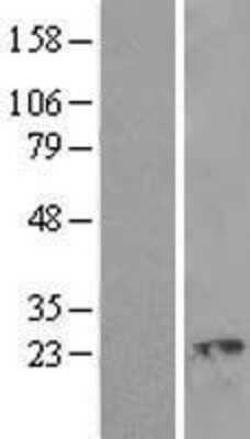 Western Blot: Ropporin 1-like Overexpression Lysate [NBL1-15476]