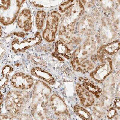 Immunohistochemistry: Roquin Antibody [NBP1-89590]