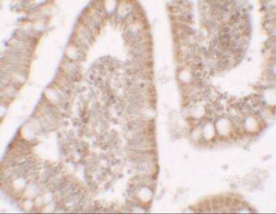 Immunohistochemistry: Roquin Antibody - BSA Free [NBP2-81891]