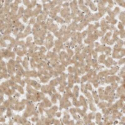 Immunohistochemistry-Paraffin: Roquin Antibody [NBP1-89589]