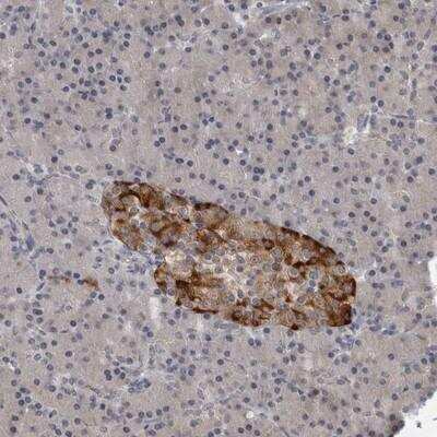 Immunohistochemistry-Paraffin: Roquin Antibody [NBP1-89591]