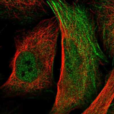 Immunocytochemistry/ Immunofluorescence: Rpn2 Antibody [NBP2-38323]