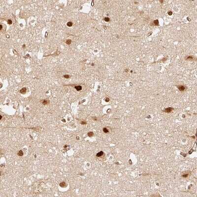 Immunohistochemistry: Rpn2 Antibody [NBP2-38323]