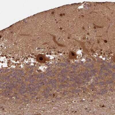 Immunohistochemistry: Rpn2 Antibody [NBP2-38324]
