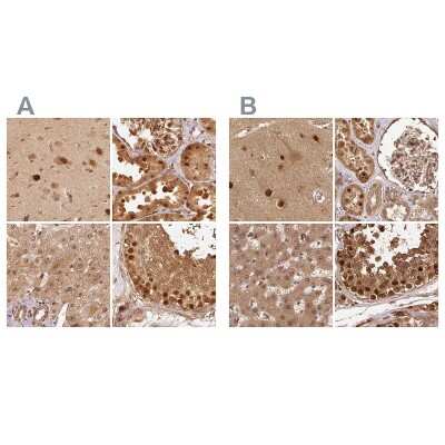 Immunohistochemistry-Paraffin: Rpn2 Antibody [NBP2-38323]