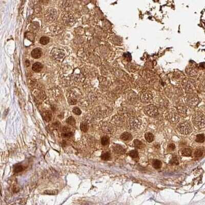 Immunohistochemistry-Paraffin: Rpn2 Antibody [NBP2-38323]