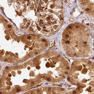 Immunohistochemistry-Paraffin: Rpn2 Antibody [NBP2-38323]