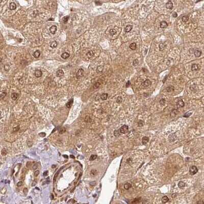 Immunohistochemistry-Paraffin: Rpn2 Antibody [NBP2-38323]