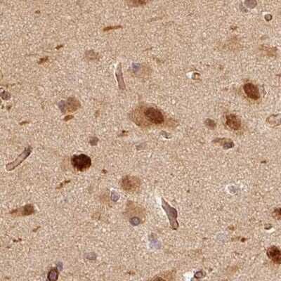 Immunohistochemistry-Paraffin: Rpn2 Antibody [NBP2-38323]