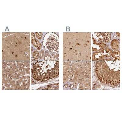 Immunohistochemistry-Paraffin: Rpn2 Antibody [NBP2-38324]