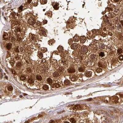 Immunohistochemistry-Paraffin: Rpn2 Antibody [NBP2-38324]
