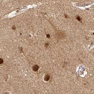 Immunohistochemistry-Paraffin: Rpn2 Antibody [NBP2-38324]
