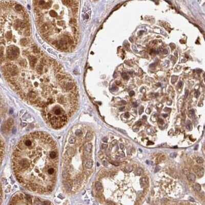 Immunohistochemistry-Paraffin: Rpn2 Antibody [NBP2-38324]