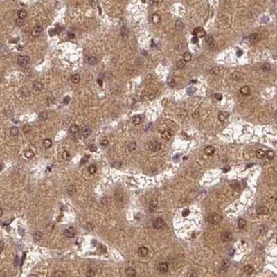 Immunohistochemistry-Paraffin: Rpn2 Antibody [NBP2-38324]