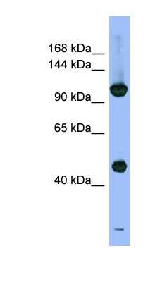 Western Blot: Rpn2 Antibody [NBP1-58214]