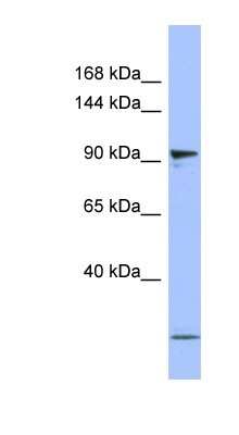 Western Blot: Rpn2 Antibody [NBP1-58221]