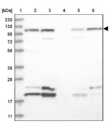 Western Blot: Rpn2 Antibody [NBP2-38323]