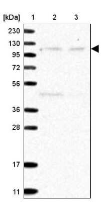 Western Blot: Rpn2 Antibody [NBP2-38324]