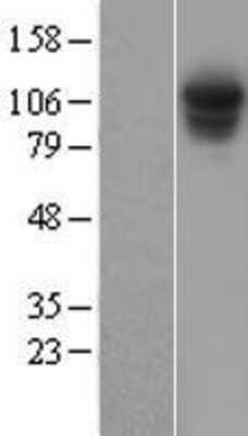 Western Blot: Rpn2 Overexpression Lysate [NBL1-14894]