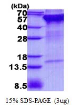 SDS-PAGE: Recombinant Human Rpn2 His Protein [NBP2-23416]