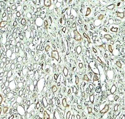 Immunohistochemistry-Paraffin: Rubicon Antibody - BSA Free [NBP2-81999]