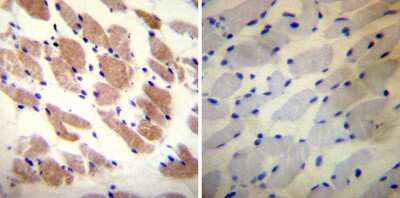 Immunohistochemistry-Paraffin: Ryanodine Receptor Antibody (34C) - BSA Free [NB300-543]