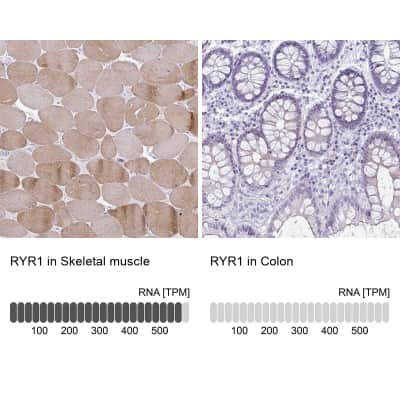 Immunohistochemistry-Paraffin: Ryanodine Receptor 1 Antibody [NBP2-33785]