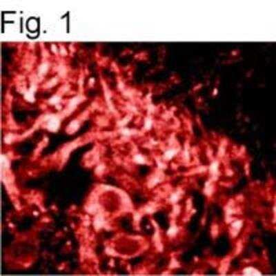 Immunocytochemistry/ Immunofluorescence: Ryanodine Receptor 2 Antibody (C3-33) - BSA Free [NBP2-80143]