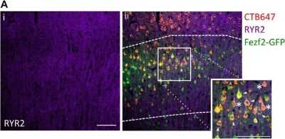 Immunocytochemistry/ Immunofluorescence: Ryanodine Receptor 2 Antibody [NBP1-90091]