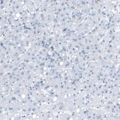 Immunohistochemistry-Paraffin: Ryanodine Receptor 2 Antibody [NBP1-90091]