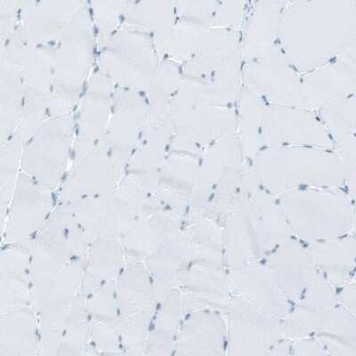 Immunohistochemistry-Paraffin: Ryanodine Receptor 2 Antibody [NBP1-90091]
